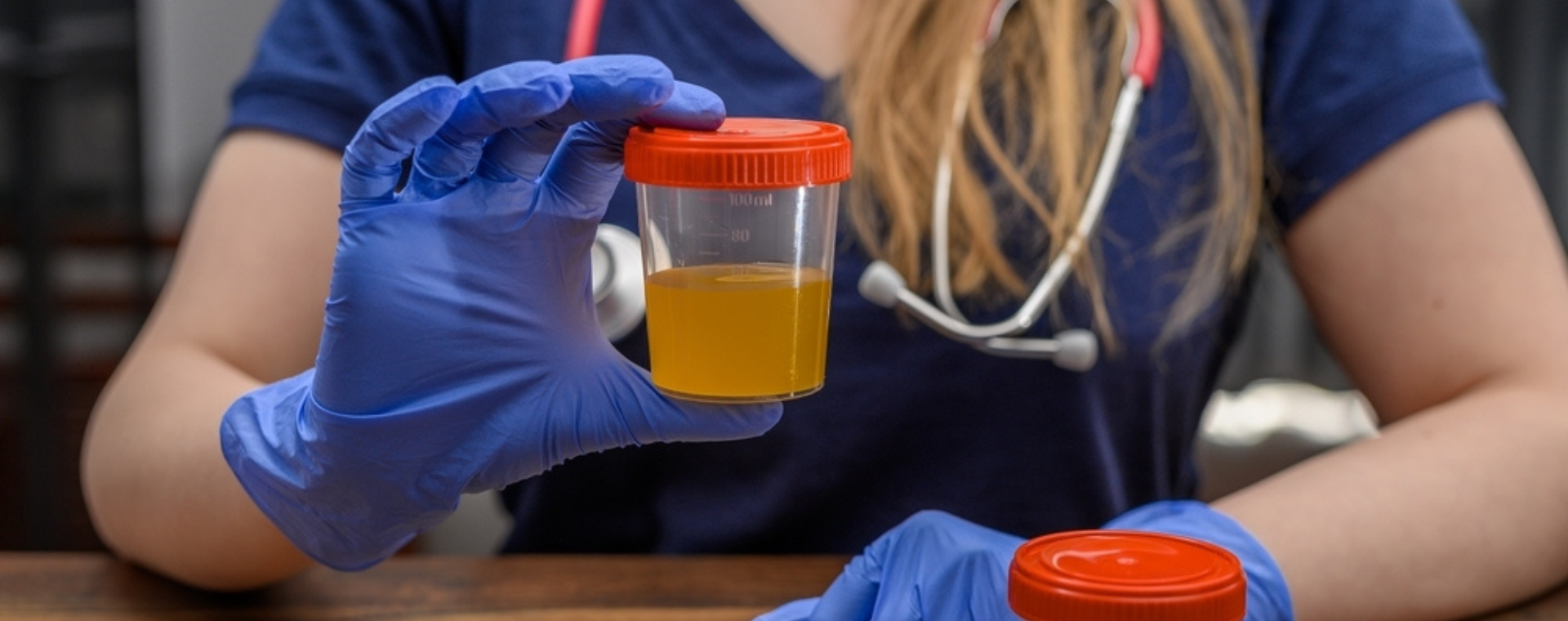 Καλλιέργεια ούρων