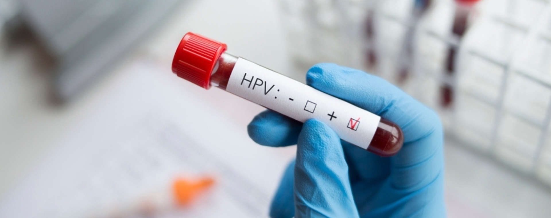 Μοριακή ανίχνευση του ιού των ανθρωπίνων θηλωμάτων